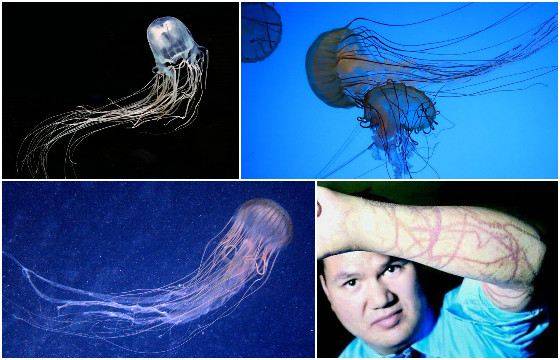 Экспертный совет: как поступить при ожоге медузы, рассказал врач